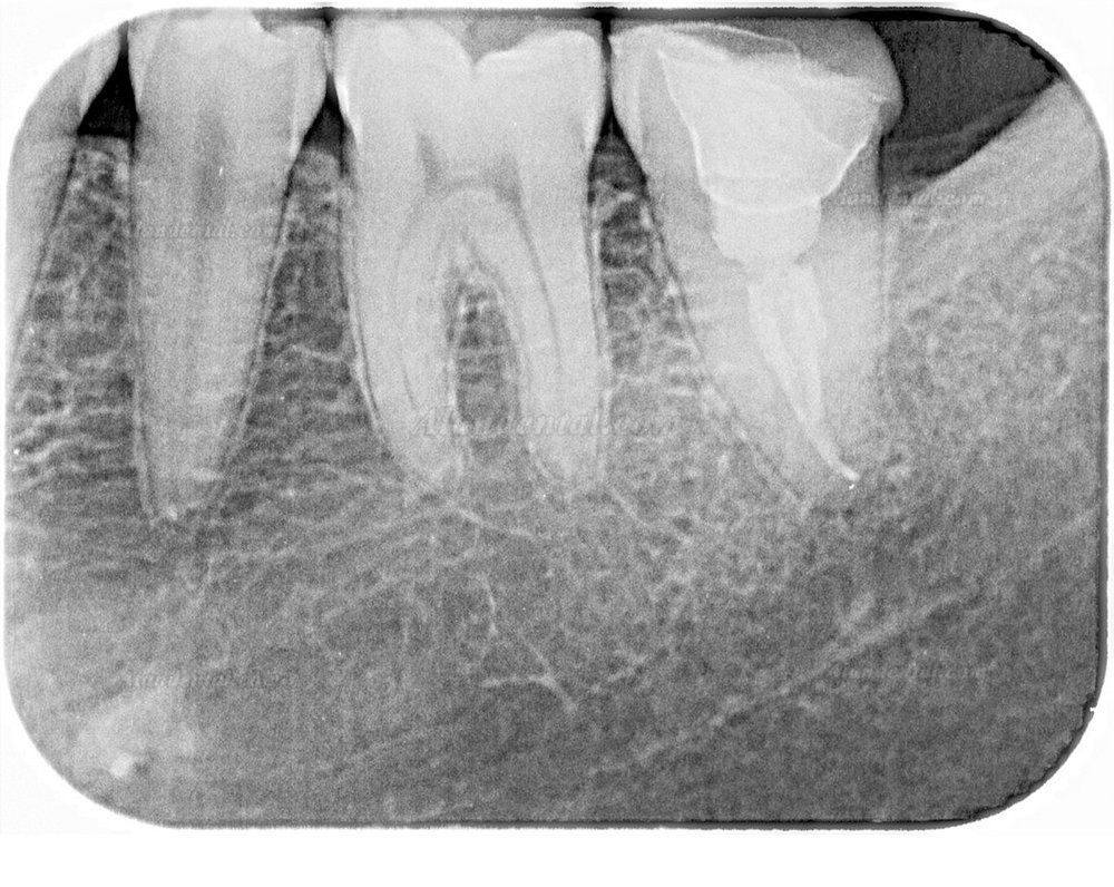 TYRIS TR-120 Dental Image Plate Scanner PSP X ray Scanner